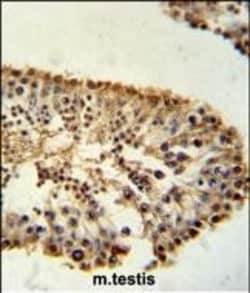 Invitrogen ERO1LB Polyclonal Antibody 400 &mu;L; Unconjugated:Antibodies,