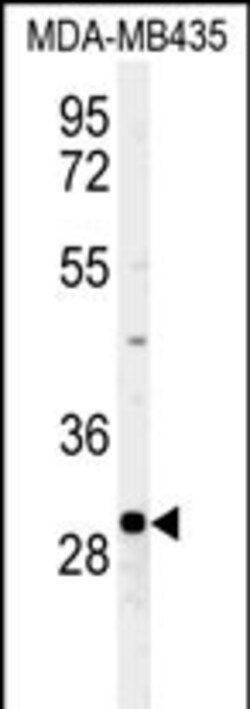 Invitrogen FBXL15 Polyclonal Antibody 400 μL; Unconjugated:Antibodies,