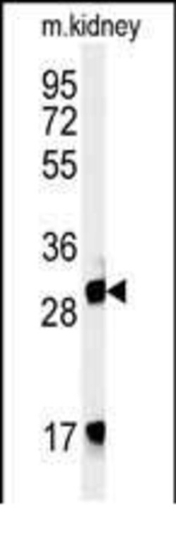 Invitrogen FBXL15 Polyclonal Antibody 400 μL; Unconjugated:Antibodies,