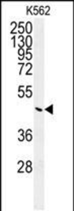 Invitrogen G6PC Polyclonal Antibody 400 &mu;L; Unconjugated:Antibodies,