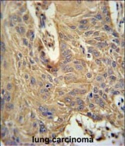 Invitrogen IL5RA Polyclonal Antibody 400 &mu;L; Unconjugated:Antibodies,
