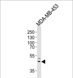 Invitrogen IL5RA Polyclonal Antibody 400 &mu;L; Unconjugated:Antibodies,