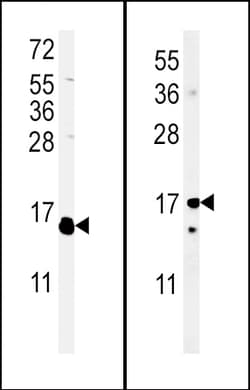Invitrogen IL-4 Polyclonal Antibody 400 &mu;L; Unconjugated:Antibodies,