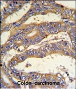Invitrogen™ RSAD1 Polyclonal Antibody
