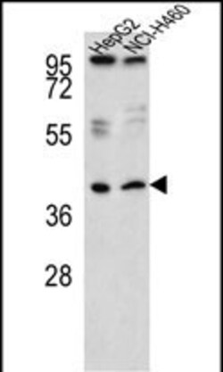 Invitrogen RSAD1 Polyclonal Antibody 400 &mu;L; Unconjugated:Antibodies,