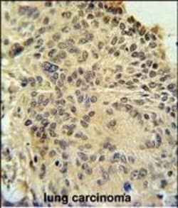 Invitrogen RSPO2 Polyclonal Antibody 400 &mu;L; Unconjugated:Antibodies,