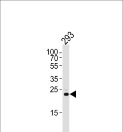Invitrogen RSPO2 Polyclonal Antibody 400 &mu;L; Unconjugated:Antibodies,