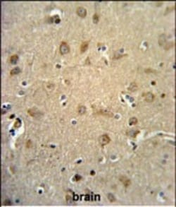Invitrogen RTN4RL1 Polyclonal Antibody 400 &mu;L | Buy Online | Invitrogen&trade; | Fisher Scientific