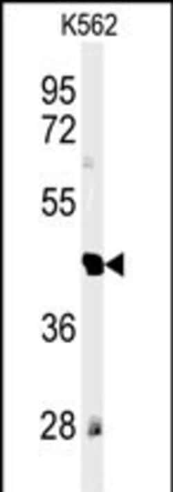 Invitrogen RTN4RL1 Polyclonal Antibody 400 &mu;L | Buy Online | Invitrogen&trade; | Fisher Scientific