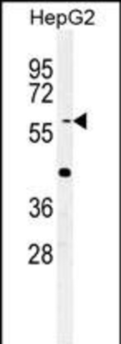 Invitrogen YLAT2 Polyclonal Antibody 400 &mu;L; Unconjugated:Antibodies,