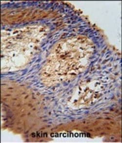 Invitrogen DHRS2 Polyclonal Antibody 400 &mu;L; Unconjugated:Antibodies,