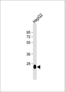 Invitrogen DHRS2 Polyclonal Antibody 400 &mu;L; Unconjugated:Antibodies,