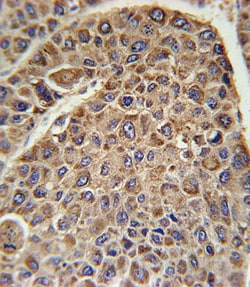 Invitrogen DLAT Polyclonal Antibody 400 &mu;L; Unconjugated:Antibodies,
