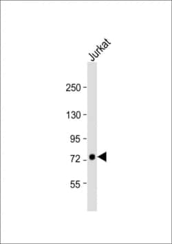 Invitrogen GGNBP2 Polyclonal Antibody 400 &mu;L; Unconjugated:Antibodies,