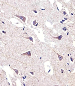 Invitrogen FADS2 Polyclonal Antibody 400 &mu;L; Unconjugated:Antibodies,