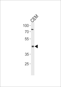 Invitrogen FADS2 Polyclonal Antibody 400 &mu;L; Unconjugated:Antibodies,