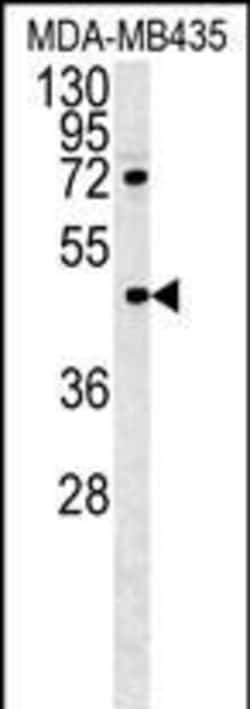 Invitrogen PYHIN1 Polyclonal Antibody 400 &mu;L; Unconjugated:Antibodies,