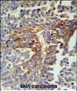 ARMC5 Polyclonal Antibody:Antibodies, Polyclonal