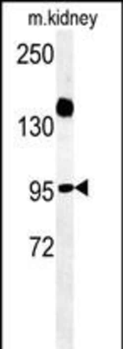 ARMC5 Polyclonal Antibody:Antibodies, Polyclonal