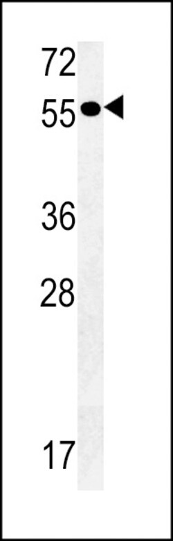 Invitrogen PTAFR Polyclonal Antibody 400 &mu;L; Unconjugated:Antibodies,