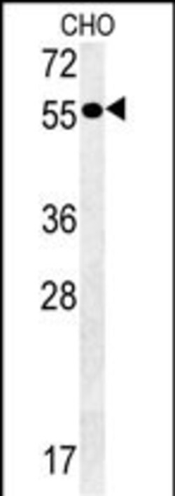 Invitrogen Pancreatic Amylase Polyclonal Antibody 400 &mu;L; Unconjugated:Antibodies,