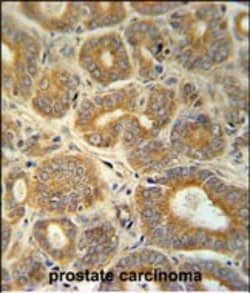 Invitrogen CRABP1 Polyclonal Antibody 400 &mu;L; Unconjugated:Antibodies,