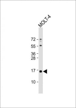 Invitrogen CRABP1 Polyclonal Antibody 400 &mu;L; Unconjugated:Antibodies,