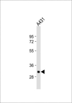 Invitrogen Tryptase Polyclonal Antibody 400 &mu;L; Unconjugated:Antibodies,