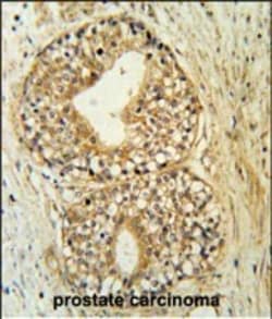 Invitrogen ATP11C Polyclonal Antibody 400 &mu;L; Unconjugated:Antibodies,