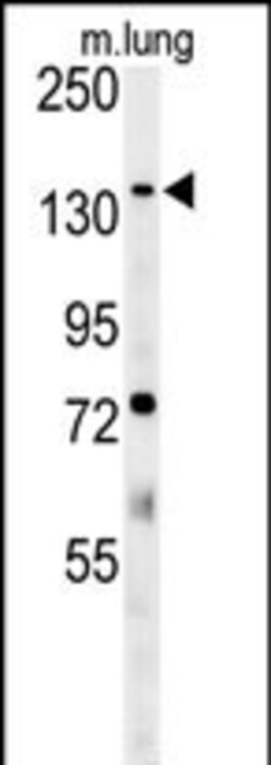 Invitrogen ATP11C Polyclonal Antibody 400 &mu;L; Unconjugated:Antibodies,