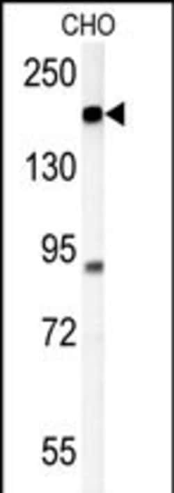 Invitrogen ATP11C Polyclonal Antibody 400 &mu;L; Unconjugated:Antibodies,