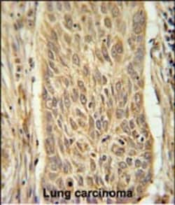 Invitrogen INMT Polyclonal Antibody 400 &mu;L; Unconjugated:Antibodies,