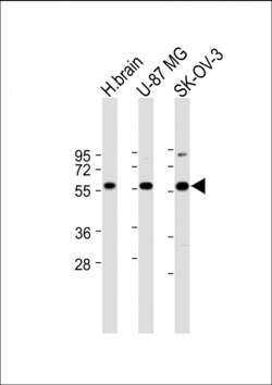 Invitrogen DYNC1LI2 Polyclonal Antibody 400 &mu;L; Unconjugated:Antibodies,