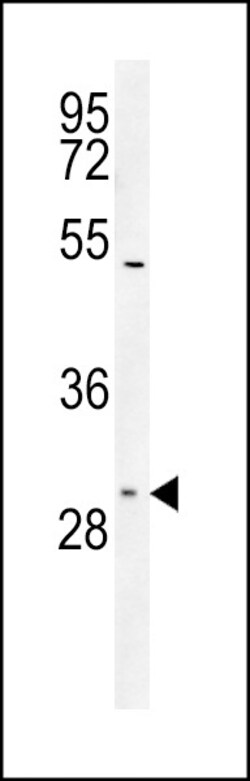 Invitrogen SLC25A1 Polyclonal Antibody 400 &mu;L; Unconjugated:Antibodies,
