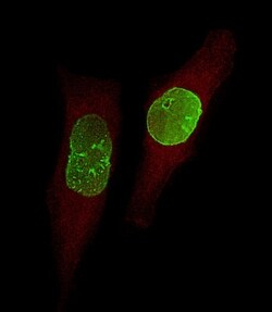 USP17 Polyclonal Antibody:Antibodies, Polyclonal