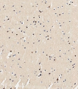 USP17 Polyclonal Antibody:Antibodies, Polyclonal