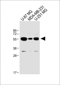 USP17 Polyclonal Antibody:Antibodies, Polyclonal