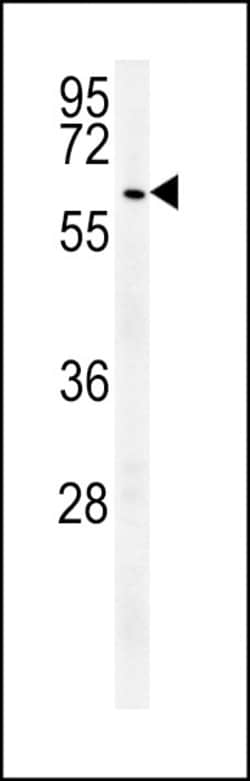 USP17 Polyclonal Antibody:Antibodies, Polyclonal