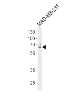 USP17 Polyclonal Antibody:Antibodies, Polyclonal