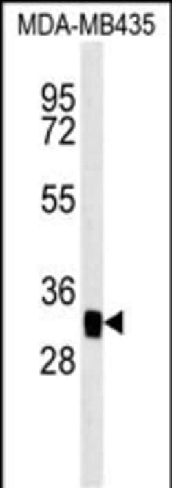 Invitrogen MTCH2 Polyclonal Antibody 400 &mu;L; Unconjugated:Antibodies,