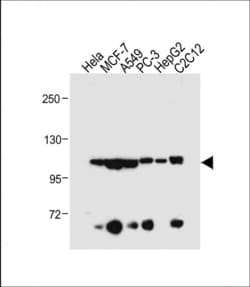 Invitrogen AHR Polyclonal Antibody 400 &mu;L; Unconjugated:Antibodies,