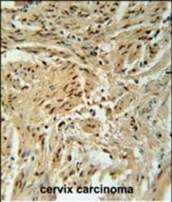 Invitrogen BLOC1S2 Polyclonal Antibody 400 &mu;L; Unconjugated:Antibodies,