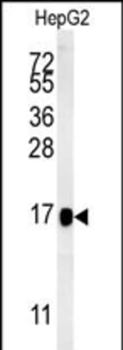 Invitrogen BLOC1S2 Polyclonal Antibody 400 &mu;L; Unconjugated:Antibodies,