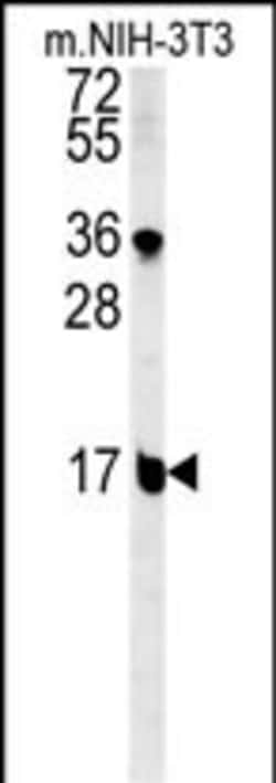 Invitrogen BLOC1S2 Polyclonal Antibody 400 &mu;L; Unconjugated:Antibodies,