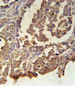 MC2R Polyclonal Antibody:Antibodies, Polyclonal