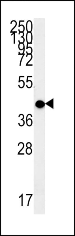 MC2R Polyclonal Antibody:Antibodies, Polyclonal