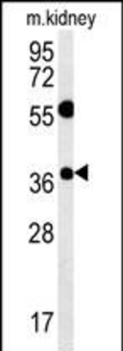 Invitrogen TSPAN3 Polyclonal Antibody 400 &mu;L; Unconjugated:Antikroppar