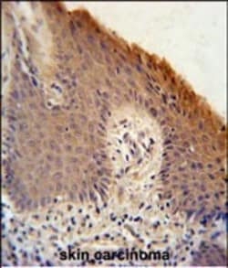 KRTAP1-1 Polyclonal Antibody:Antibodies, Polyclonal