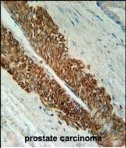 Invitrogen STEAP2 Polyclonal Antibody 400 &mu;L; Unconjugated:Antibodies,