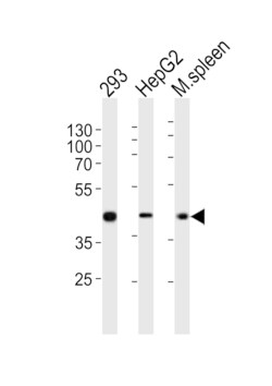Invitrogen STEAP2 Polyclonal Antibody 400 &mu;L; Unconjugated:Antibodies,